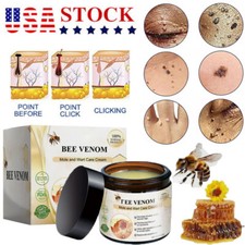 Bee Venom Skin Tag Removal Treatment Cream Body Care Mole Corn Wart Remover