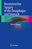Reconstructive Surgery Of The Oesophagus And Stomach Muntzer Mughal