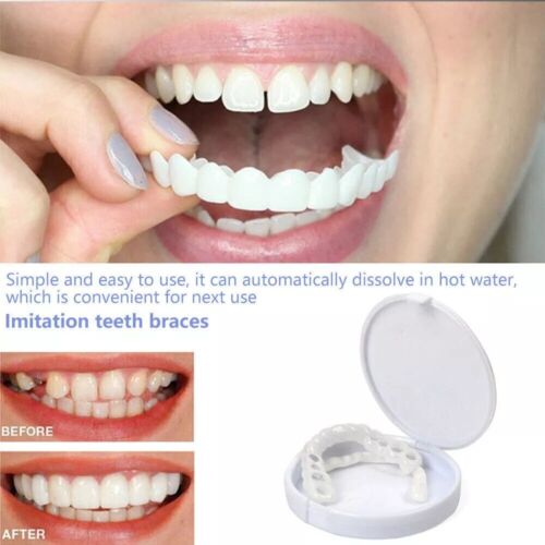 Juego de dientes postizos superior e inferior a presión carillas dentales dentaduras postizas cubierta dental falsa - Imagen 4 de 15
