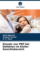 Einsatz Von Prp Bei Defekten Im Kiefer-Gesichtsbereich Amit Agarwal (U. A.) Buch