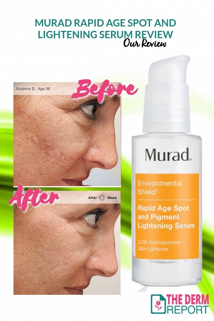 murad cream for pigmentation