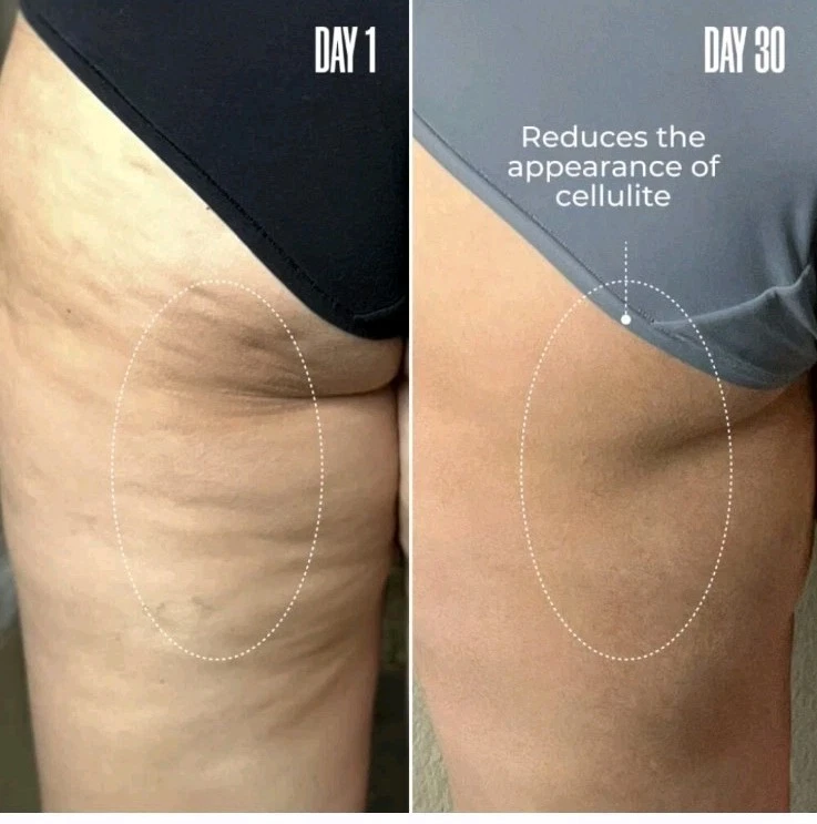 NIB Maely's B-Tight Lift & Firm Booty Mask!! - Image 2 of 4