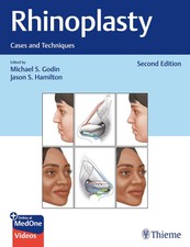 Michael S. Godin ~ Rhinoplasty 9781684200603
