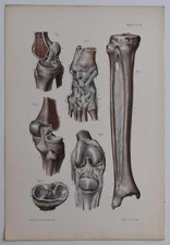 Anatomy Syndesmology Joints Color Engraving 1844