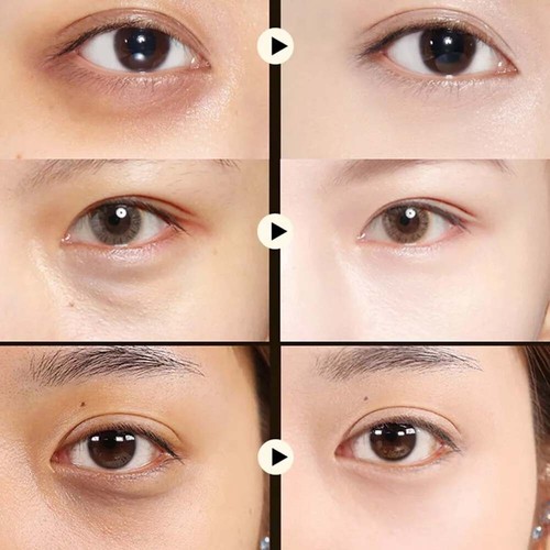 60 PCS Avocado Eye Mask Anti Aging ,Wrinkles Dark Circles Eye Bags Moistrize - Picture 11 of 24