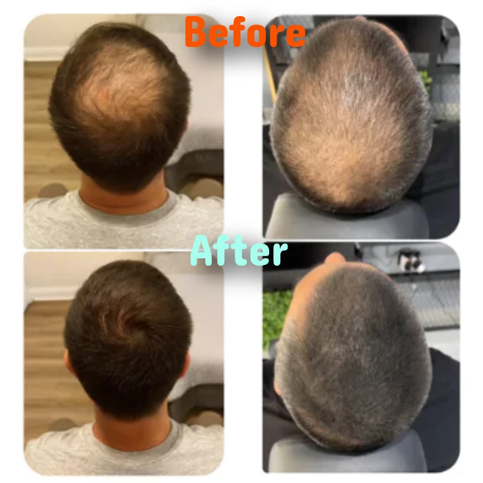 Relleno instantáneo impermeable para la línea del cabello cubre el adelgazamiento de raíces grises en segundos Foto 2 de 4