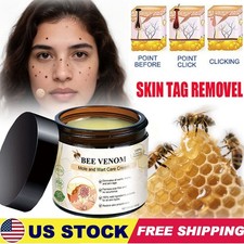 Bee Venom Skin Tag Removal Treatment Cream Body Care Mole Corn Wart Remover