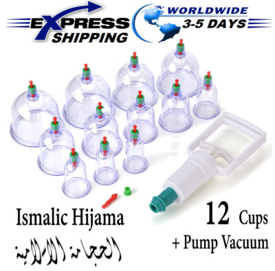 Hijama Cupping Points Chart