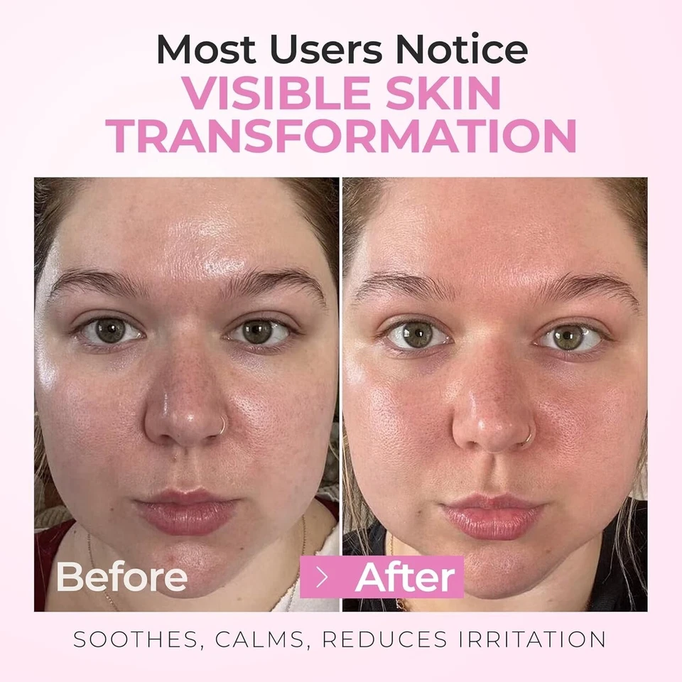 InstaSkincare toner de ácido glicólico 8% para rotina facial com ácido hialurônico 8 oz - Imagem 4 de 4