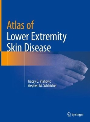 Atlas of Lower Extremity Skin Disease by Tracey C. Vlahovic (English) Hardcover