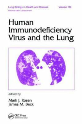 Human Immunodeficiency Virus and the Lung, Hardcover by Rosen, Mark J. (EDT);...
