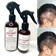 Scalp Treatment Spray