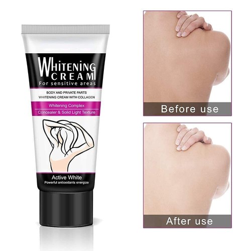 Crema Blanqueadora Para La Piel Aclarar Manchas En Partes Intimas Axilas Cuello - Picture 18 of 24