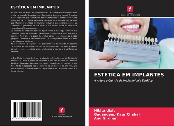 EstÉTica Em Implantes A Arte E A CiêNcia Da Implantologia EstéTica Dixit (U. A.)-image