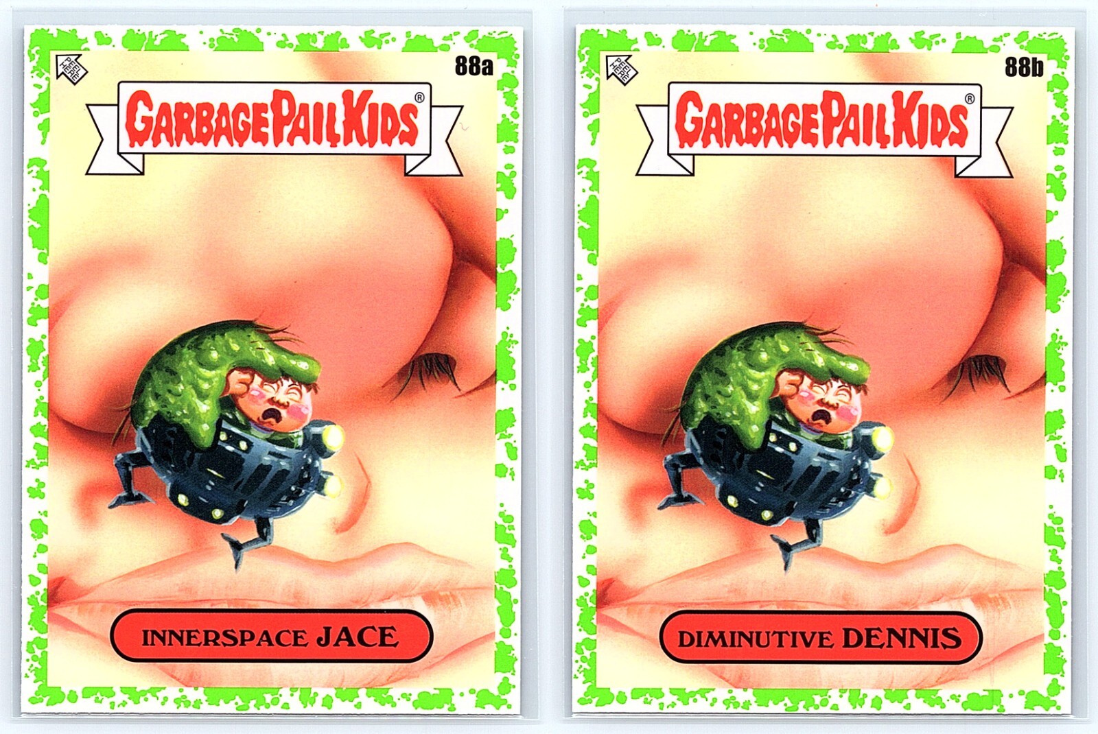 Dennis Quaid Martin Short Innerspace Garbage Pail Kids SP 2-Card Set
