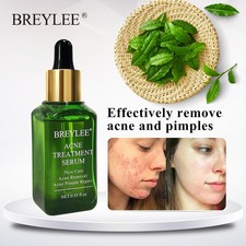 BREYLEE Acne Treatment Serum Face Facial Anti Acne Scar Removal Cream Skin Care