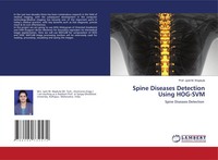 Jyoti M. Waykule | Spine Diseases Detection Using HOG-SVM | Taschenbuch (2021)