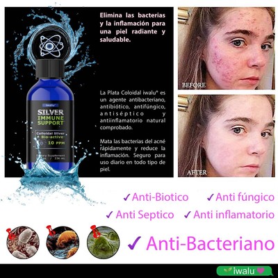 REMEDIO RAPIDO ACNÉ Cara, Espalda, Nariz Aclara ESPINILLAS Puntos Negros 4oz