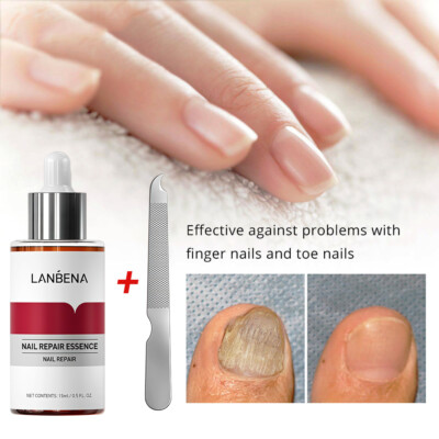 U29991 LANBENA Nail Repair Essence Remove Onychomycosis Serum Fungal Nai G1N
