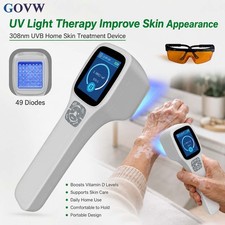 Portable 308nm UVB Excimer Light Therapy Device Narrowband Phototherapy System