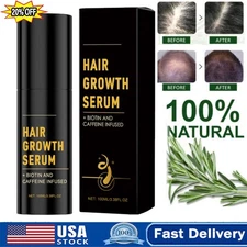 Grow Hair Growth Spray 100ml Natural Hair Thickening Gentle Regrowth Mist