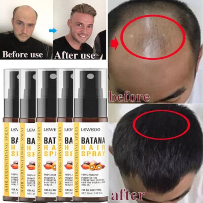 LEWEDO 1~6 Pack Batana Oil Hair Growth Healthy Thick Hair Anti Hair Loss Batana Spray