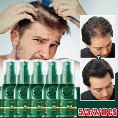 Ginger Hair Regrowth Serum Spray ShougaGRO Japanese Hair Growth Spray Anti Loss