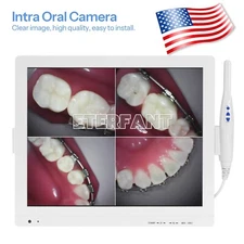 5MP Dental Intra Oral Camera 6 LED High-definition macro lens +17inch LCD screen