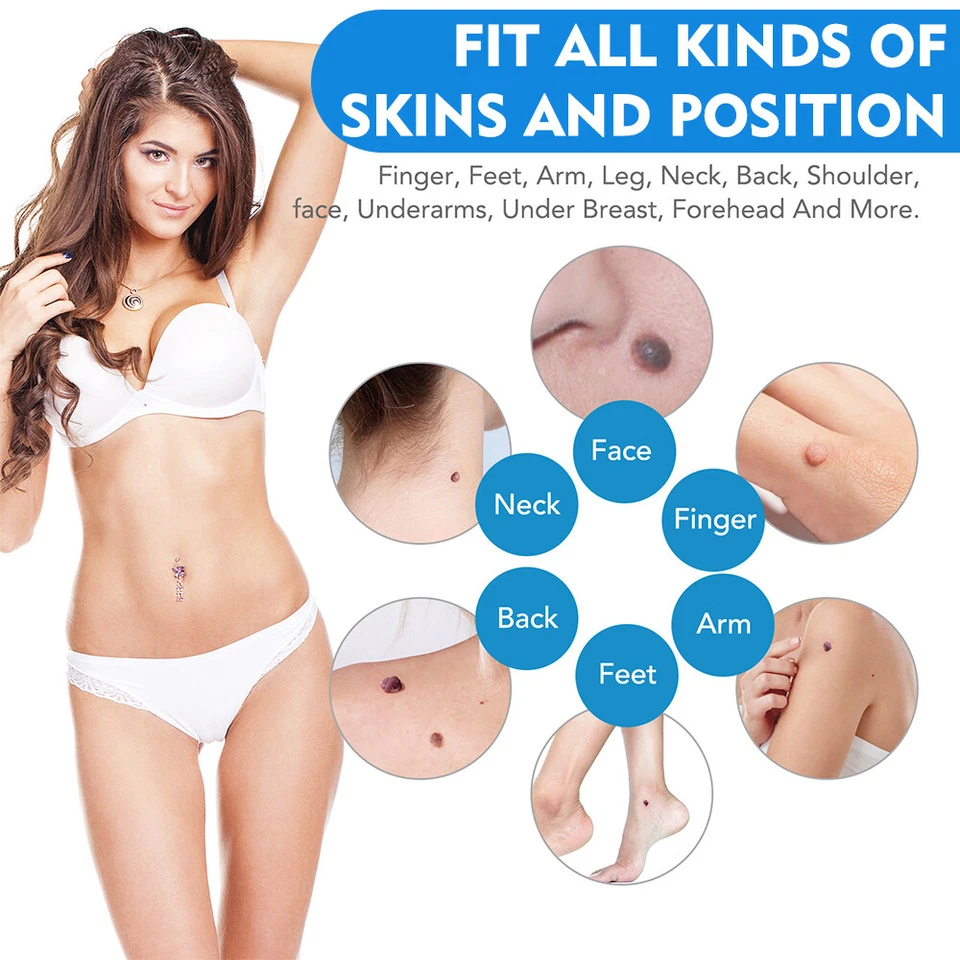 Auto Micro Skin Tag Remover Pen Device Kit Safe Painless Removal Skin Care Tool - Image 4 of 4