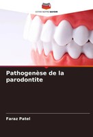 Faraz Patel | PathogenèSe De La Parodontite | Taschenbuch | FranzöSisch (2023)