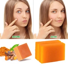 2PCS Tumeric Soap Skin Whitening Dark Spots Lightening Anti Acne Brightening