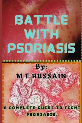 Battle with psoriasis: Complete guide to fight psoriasis by Feda Hussain Mir Pap