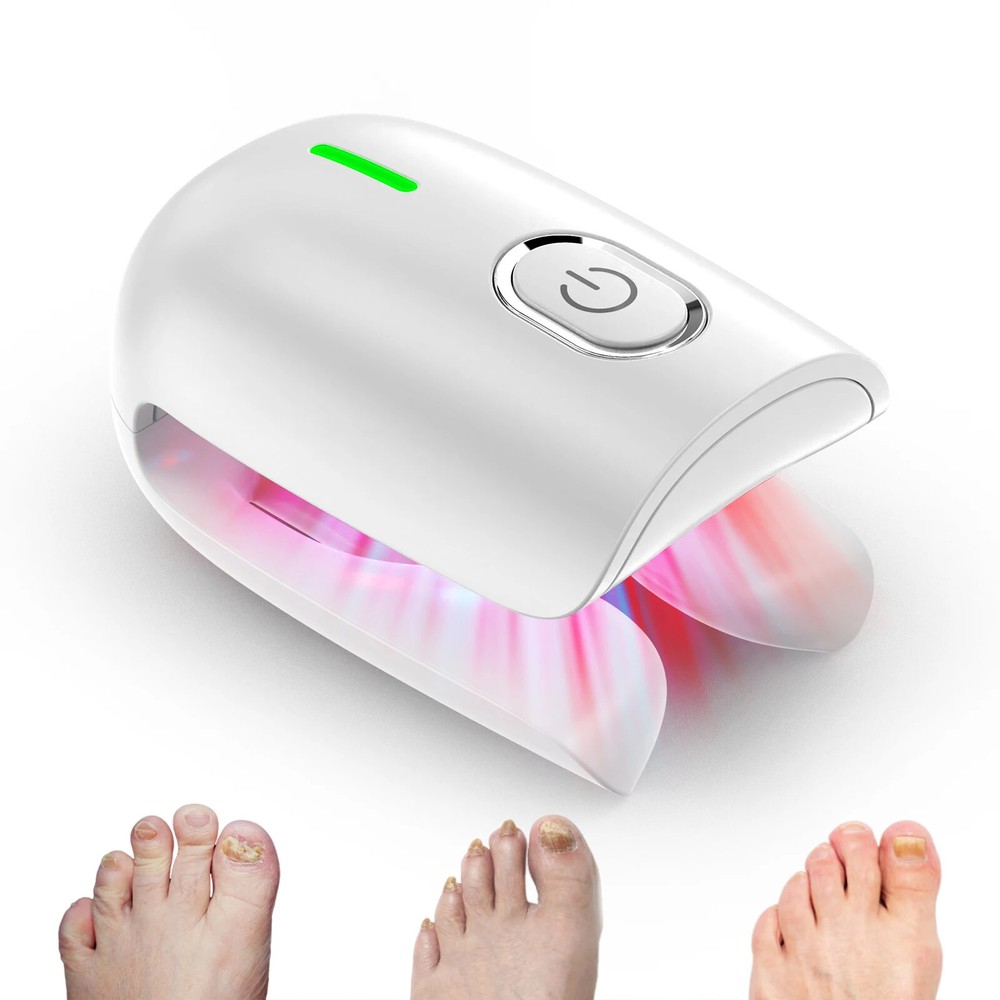Nail Fungus Laser Device Toenails Cleaning Devices Fungal Nail Laser Device