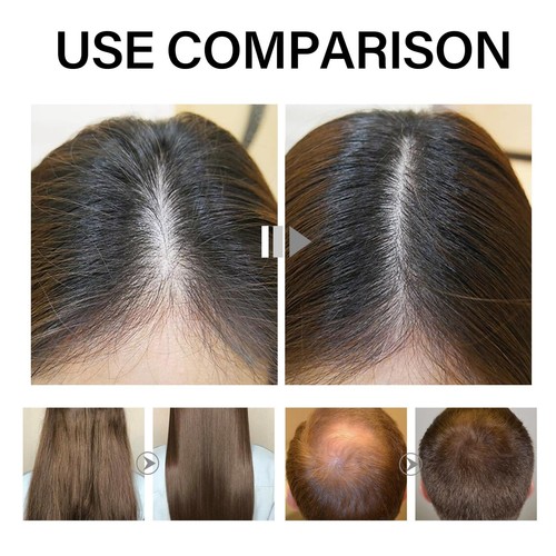 Desoxyribose Zucker Gel Haarwachstum - Desoxy Ribose Zucker Haarwachstum 60ml Desoxy... - Bild 5 von 6
