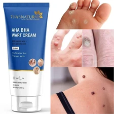 7 Days Genital Wart Removal Cream for Men & Women 50 gm Free shipping