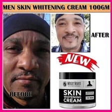 Dark Skin Bleaching Cream Whitening Lightening AHA - Face  Body 100gm