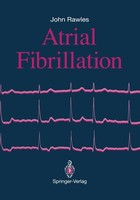 John Rawles / Atrial Fibrillation9781447119005