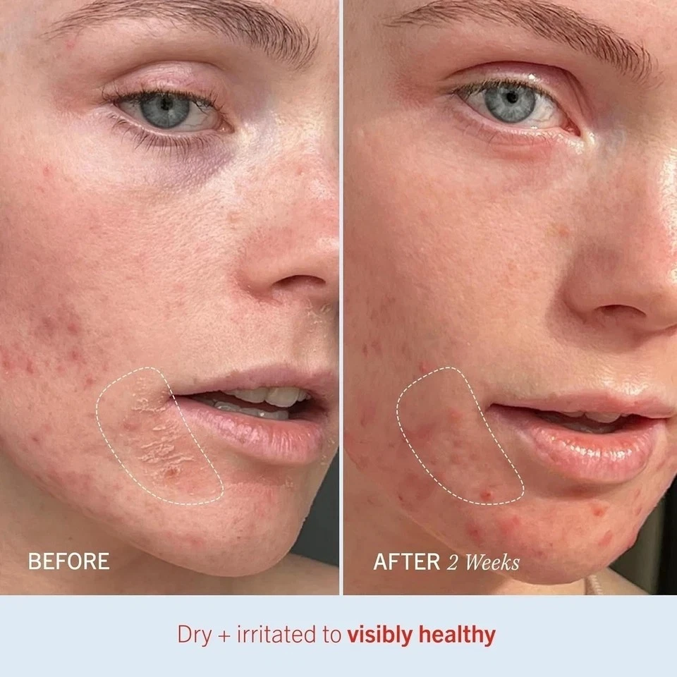 Face Body Brightening Lightening AHA Skin Whitening Dark Spot Remover Cream 50gm - Image 4 of 4