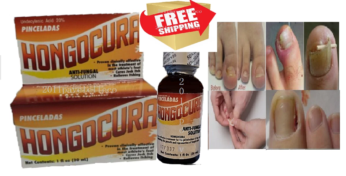 Aggregate more than 130 clear nail polish on ringworm latest ceg.edu.vn