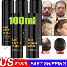 1-5PACK Hair Growth Spray 100ml Natural Hair Thickening Gentle Regrowth Mist US