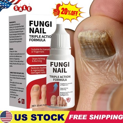 Fungi-Nail Anti-Fungal Liquid SolutionKillsFungus That Can Lead To Nail 2025 New