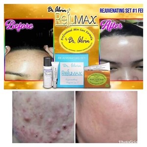 dr alvin whitening set