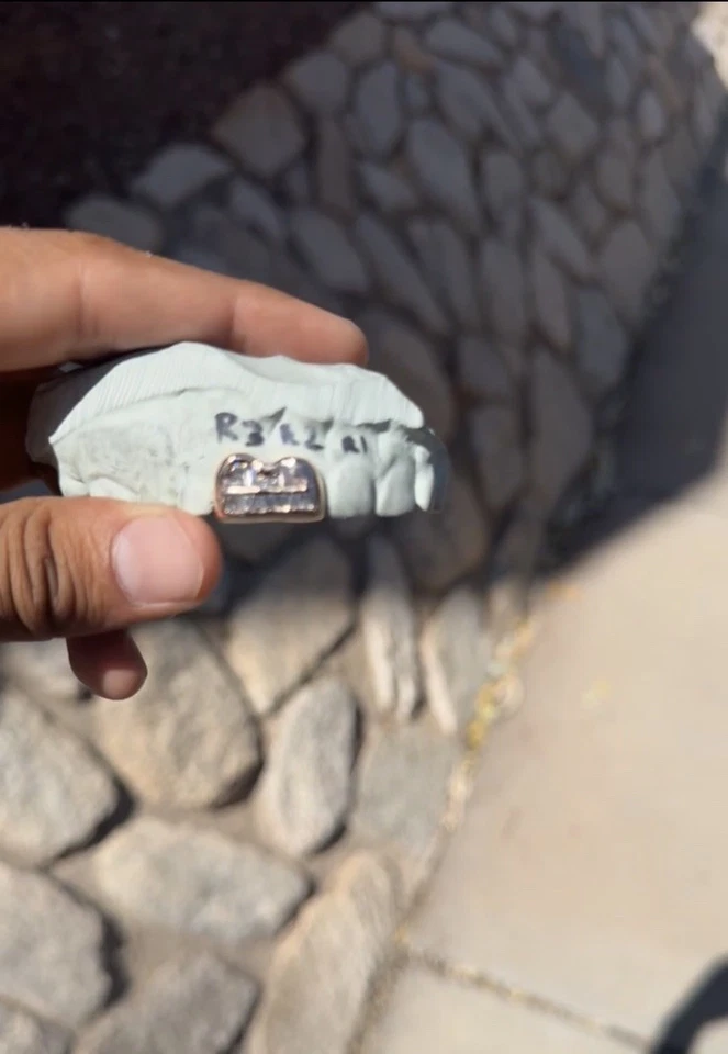 Grillz 14K Rose Gold Si Baguettes/Princess Cut Diamonds , Two Teeth ￼ - Image 3 of 4