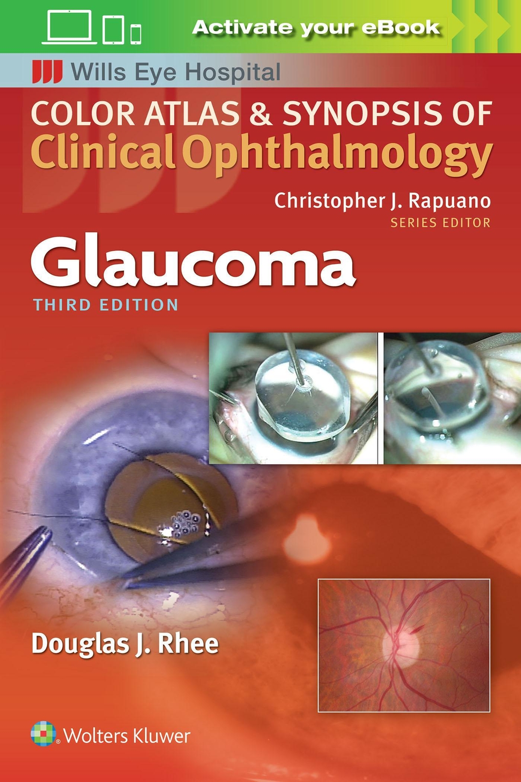 Thumbnail - Glaucoma (color Atlas And Synopsis Of Clinical Ophthalmology) |