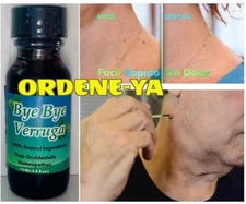 Bye Bye Verruga Sani Skin Skim Away Of Wart Remover Tag SaniSkin Out Verrugas 