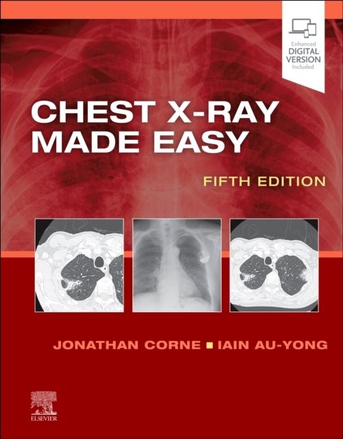 Chest X-Ray Made Easy Corne Au-Yong Paperback 9780702082344 5e