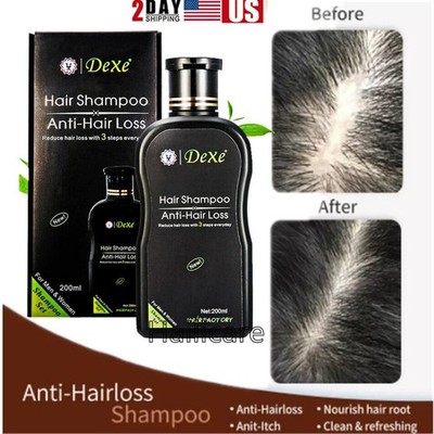 DEXE 200ml Anti-Hair Loss Shampoo Chinese Herbal Hair Regrowth For Men&Women US