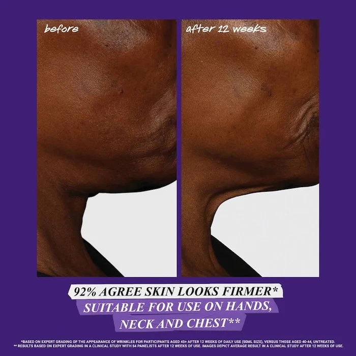 KIEHL’S RETINOL SUERO MICRODOSIS DIARIO CON CERAMIDAS Y PÉPTIDO (1 OZ/30 ML) NUEVO Foto 4 de 4