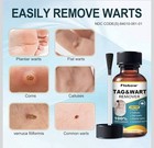 Fast-Acting Wart Remover Gel with 17% Salicylic Acid Liquid, For Plantar, Flat — photo 2