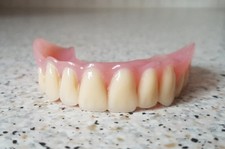 Zahnprothese,zahnersatz,prothese,oberkiefer, dental,Gebiss,Klein Gauman Hufeisen